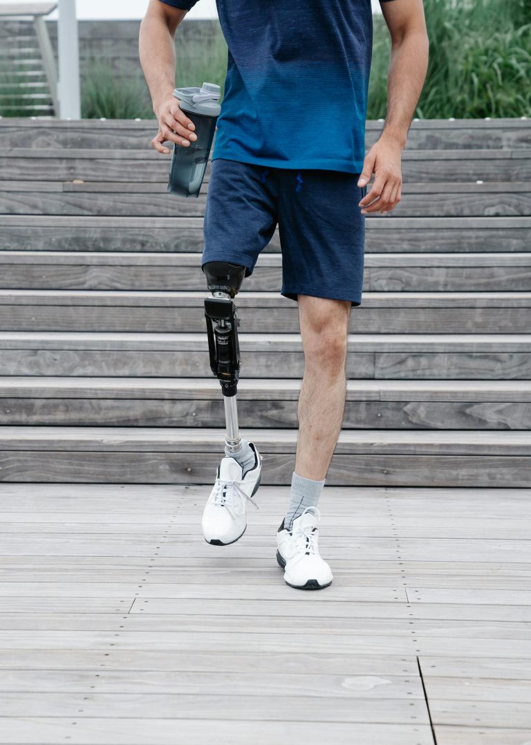 Man with prosthetic leg walking downstairs, promoting active lifestyle and body positivity.
